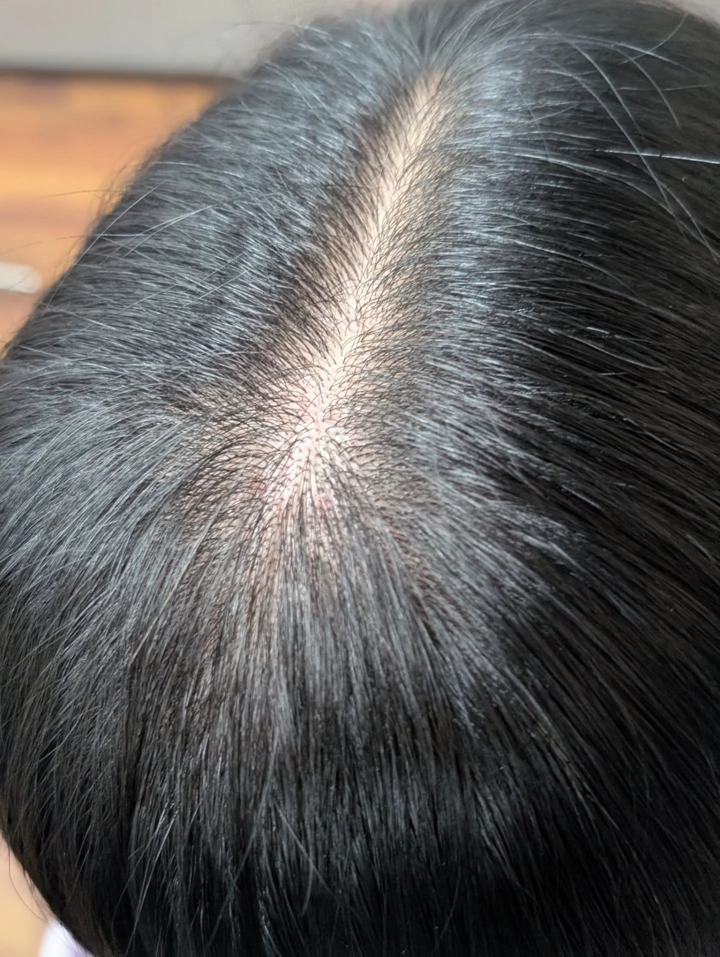 ジアミンアレルギーで染めるのを諦めていませんか。